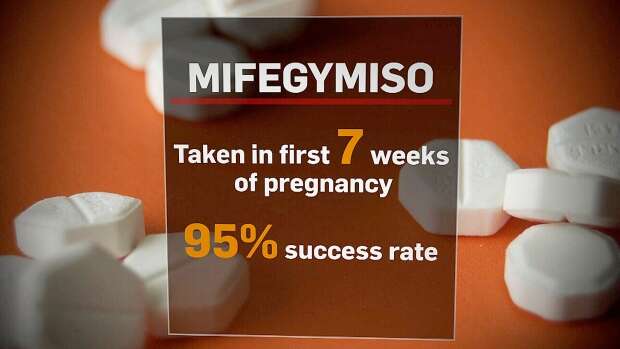 Safe Abortion Clinic in Douglas